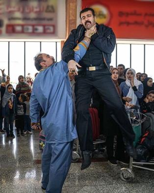 سندرم دست بیگانه چیست؟