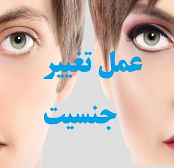 عمل تغییر جنسیت