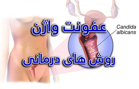 درمان عفونت واژن