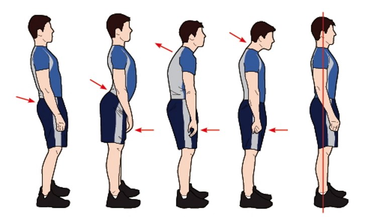 اصلاح وضعیت نشستن و ایستادن شما برای ستون فقرات