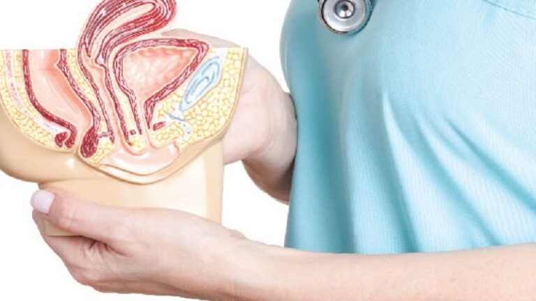 هزینه جراحی افتادگی رحم در سال 1402